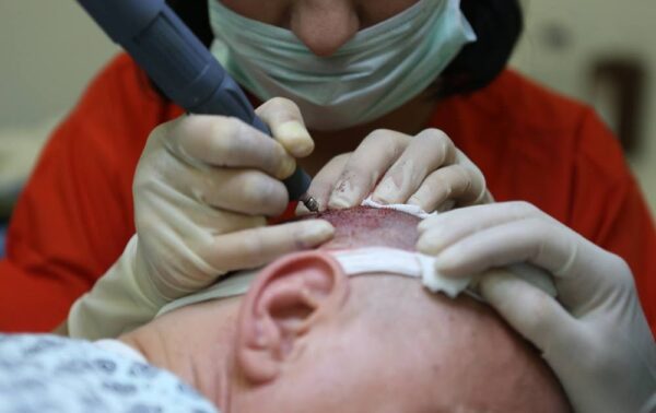 زراعة الشعر في تركيا .. تعرف على 4 مراكز لزراعة الشعر وأهم الأسعار 5 مركز كوزميديكا فى اسطنبول